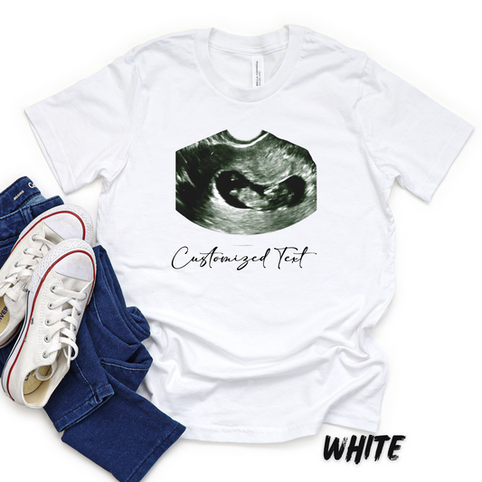 Custom Ultrasound Photo T-Shirt – Personalized Gift for Kids & Adults